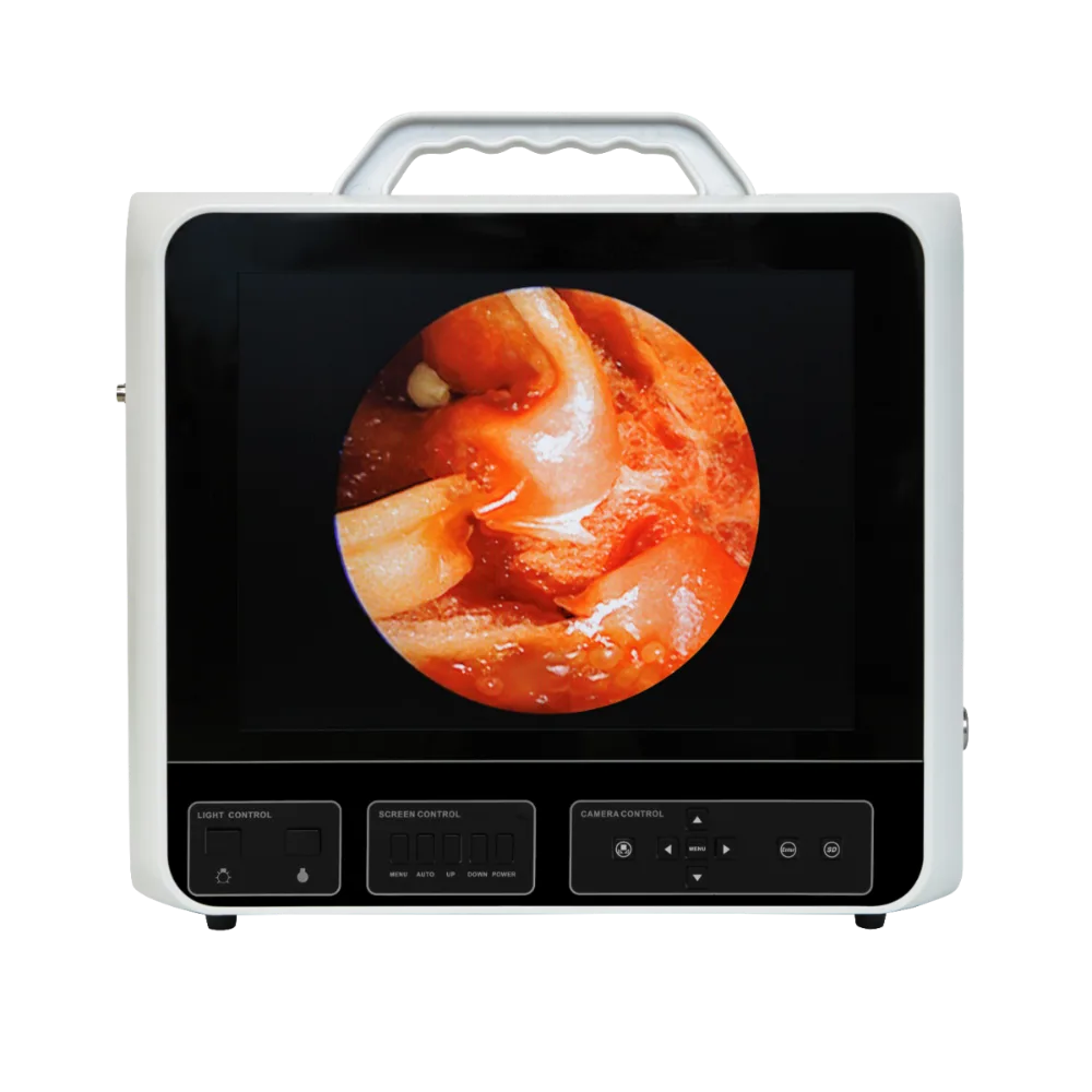 Видеосистема DS.Vision SD 3in1 15″